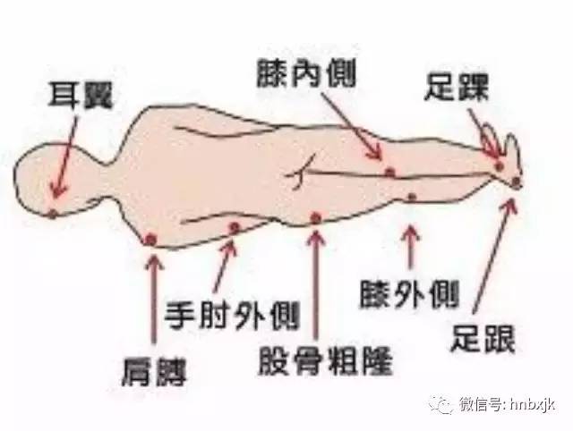 最新壓瘡護理，愛的守護與陪伴之路